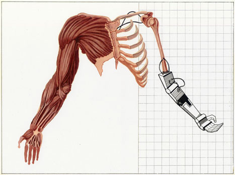 Arm